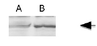 FMR | Fumarate reductase in the group Antibodies Plant/Algal / Chlamydomonas reinhardtii at Agrisera AB (Antibodies for research) (AS12 2618)